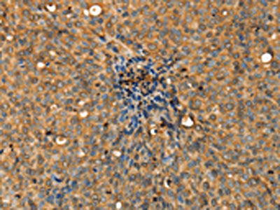 ADCY3 Antibody