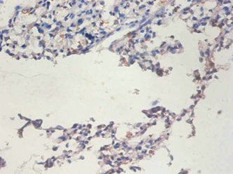 TERT Antibody