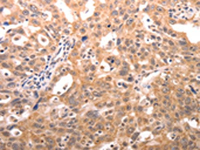 SERPINC1 Antibody