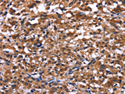 IL1A Antibody