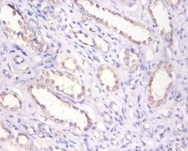 BMP6 Antibody