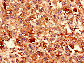 CDH3 Antibody