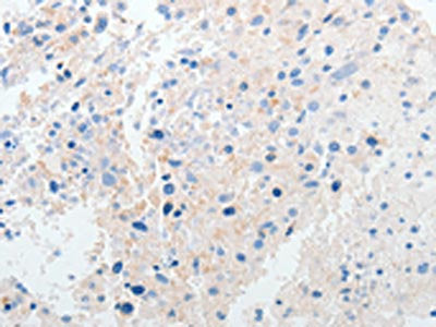 PRMT5 Antibody