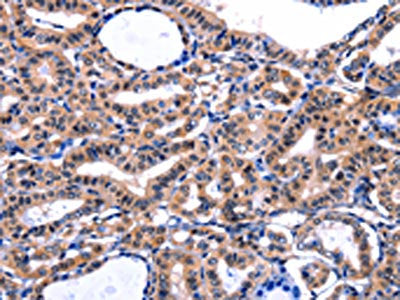 FBN1 Antibody