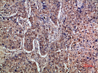 IFNAR1 Antibody