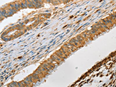 GZMB Antibody