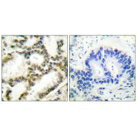 PARK7 Antibody