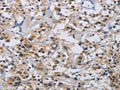 ITGA11 Antibody