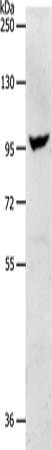 NFATC2 Antibody