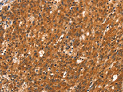 DAB2IP Antibody