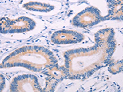 TEKT4 Antibody