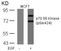 Phospho-RPS6KB1 (Ser424) Antibody