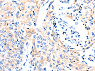 GAS6 Antibody