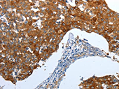 CEACAM5 Antibody