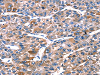 RPL11 Antibody