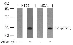 Phospho-TP53 (Thr18) Antibody