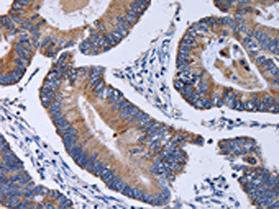 CA4 Antibody