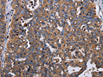TRIM13 Antibody