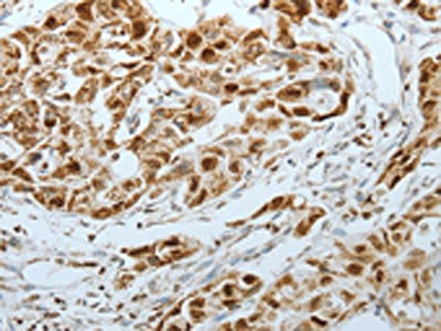 MCM3 Antibody