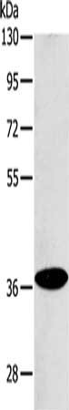 ACMSD Antibody