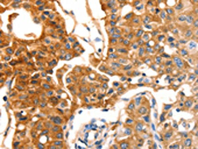 MVP Antibody