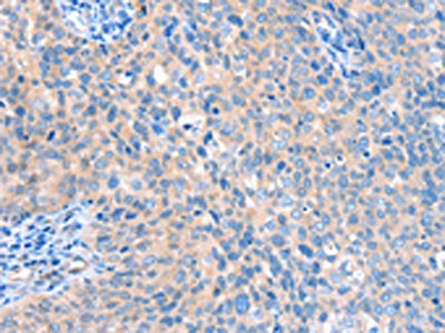 ACOX1 Antibody