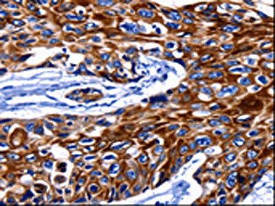 KRT10 Antibody