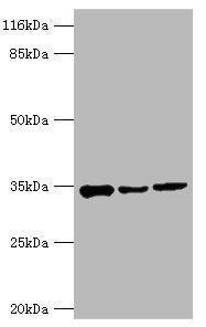 AQP4 Antibody