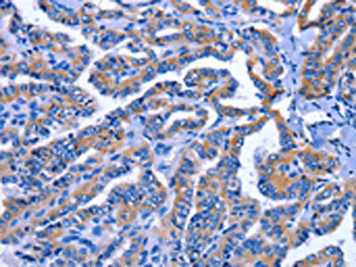 IGSF10 Antibody