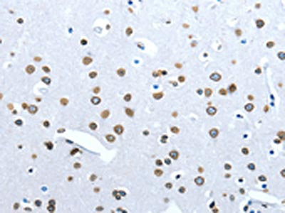 ACE2 Antibody
