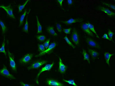 TSHR Antibody