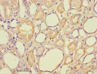 HAGH Antibody