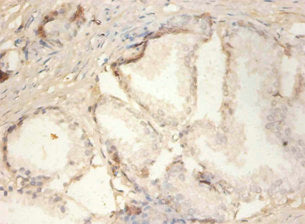 PLA2G2A Antibody