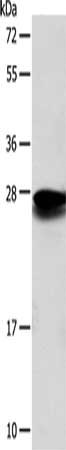 SOD2 Antibody