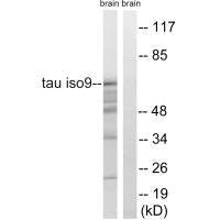 MAPT (Ab-717/400) Antibody