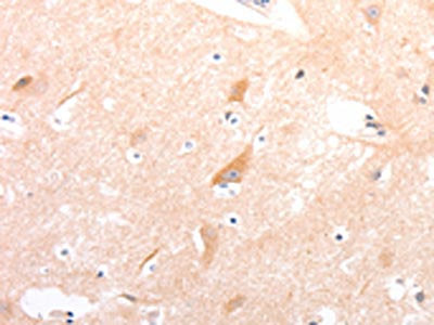 CELSR2 Antibody