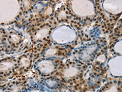 RUNX1T1 Antibody