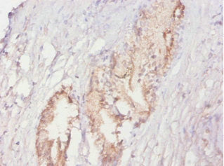 ACPP Antibody