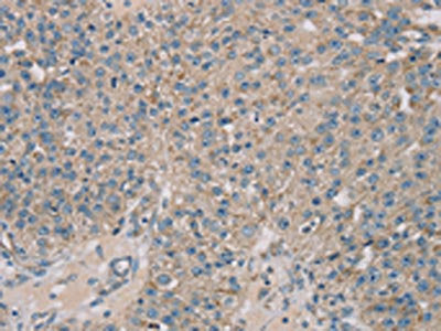 ROBO2 Antibody