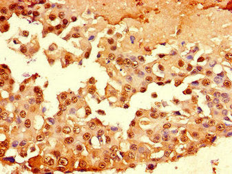 MUC1 Antibody