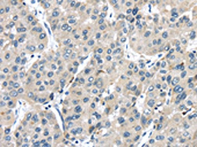 TRPM2 Antibody