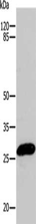 CBX5 Antibody