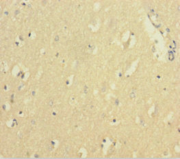 FTL Antibody
