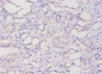 FTL Antibody