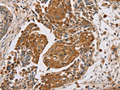 MUC1 Antibody