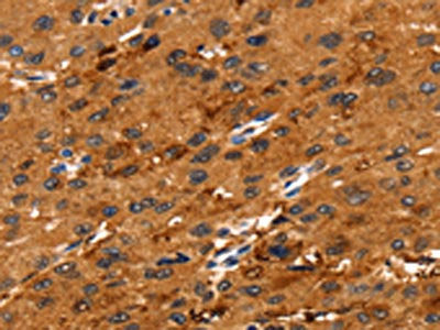 FGFR3 Antibody