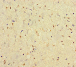 IFNAR2 Antibody