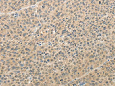 AFF2 Antibody