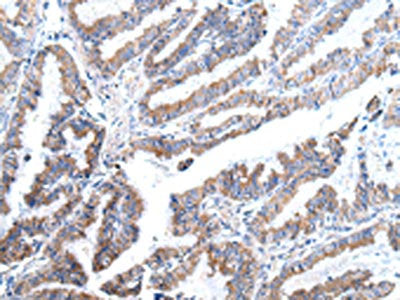 XKR4 Antibody