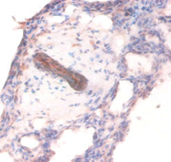 COL4A1 Antibody